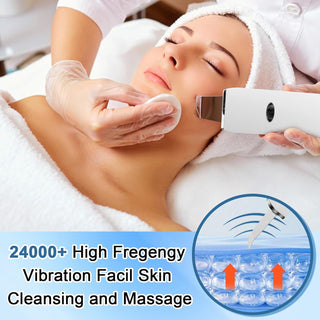 Peeling Ultrasónico Facial, 5 En 1 Espatula Para Limpieza Facial, Eliminador De Puntos Negros, Limpieza De Poros, Raspador Ultrasónico Facial, Limpiador De Poros Portátil