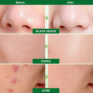Blackhead Remover Mask, Peel off Máscara,Mascarilla Exfoliante, Mascarilla Negra, Deep Cleansing Mascarilla Exfoliante Limpiadora Contra Puntos Negros Y Acné Para, Mascarillas Hidratantes